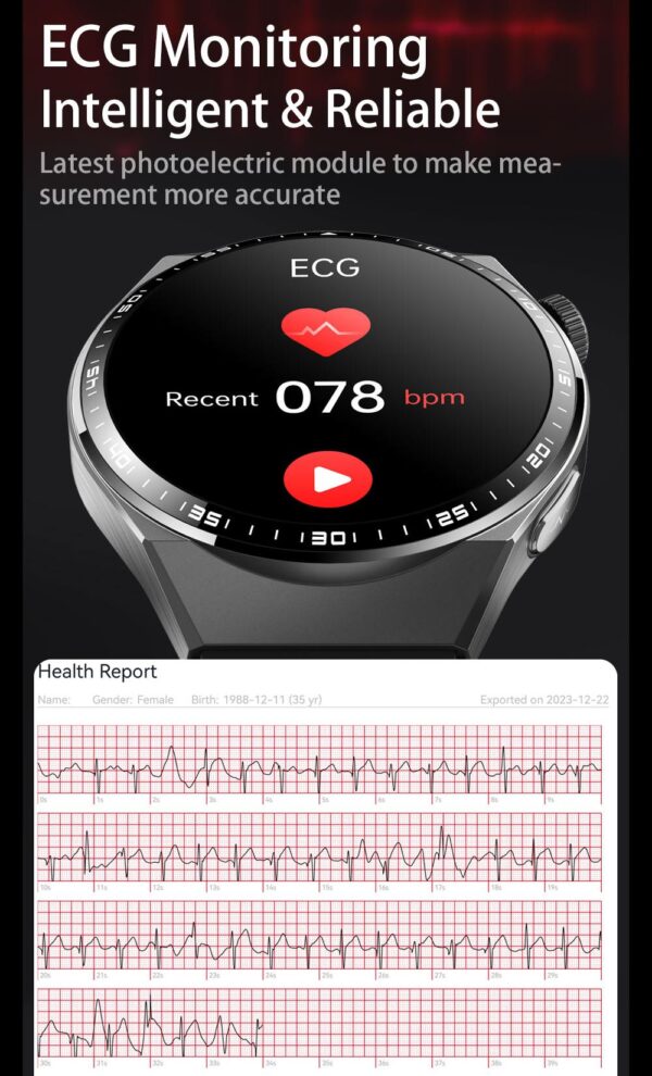 ecg monitor
